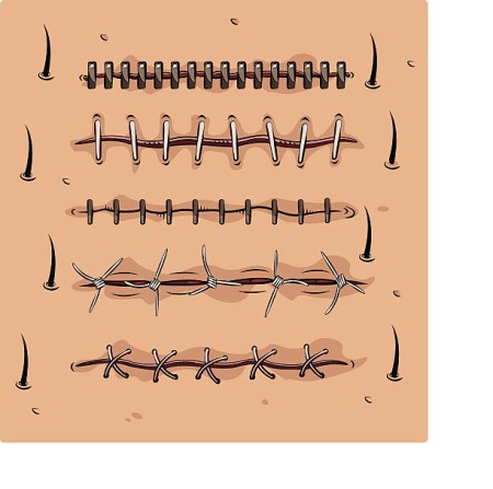 Soft Tissue Instruments 3